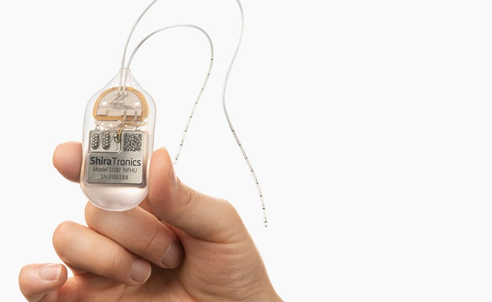 ShiraTronic neuromodulation device for migraine treatment