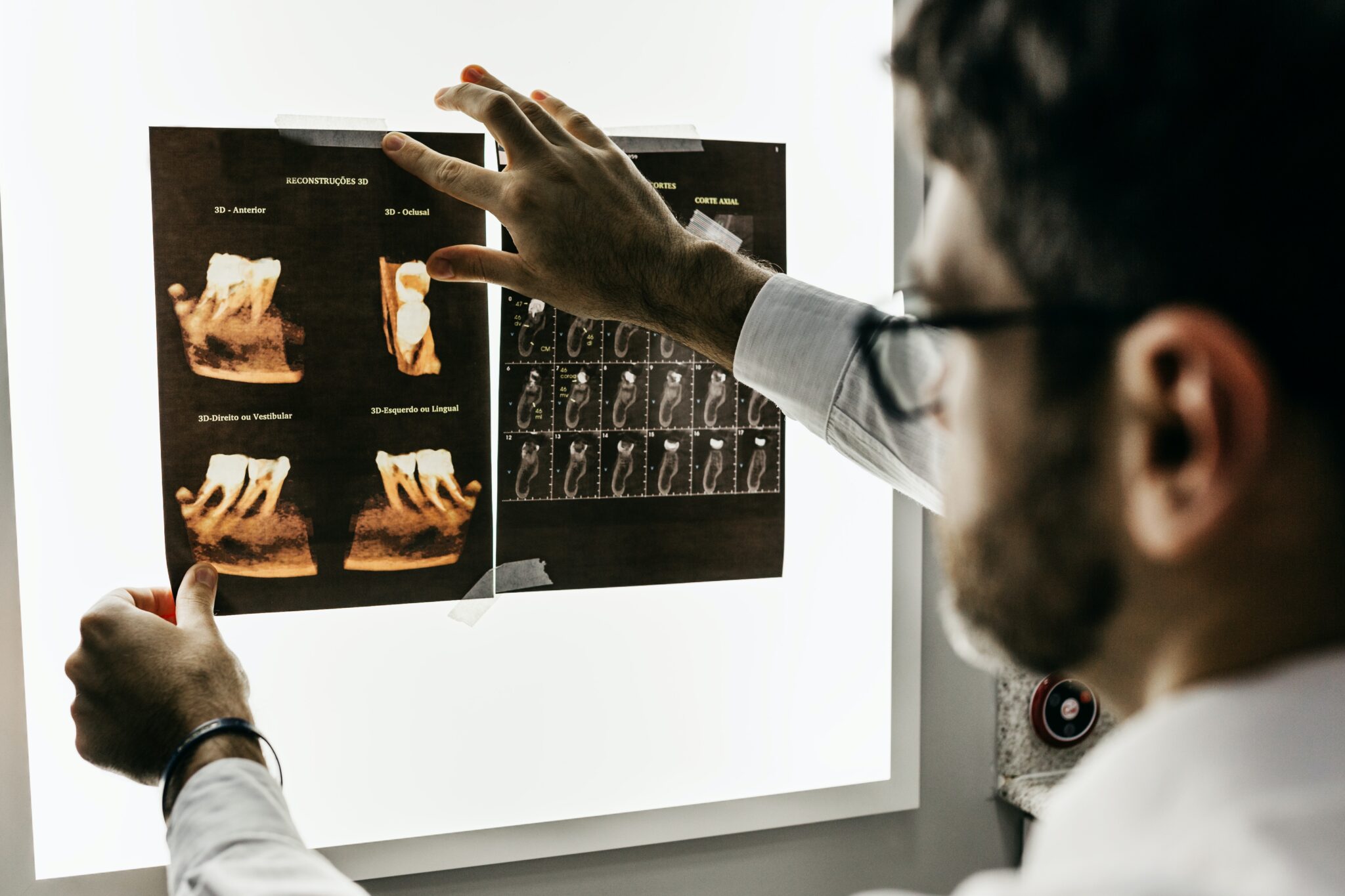 Doctor examines medical x-ray